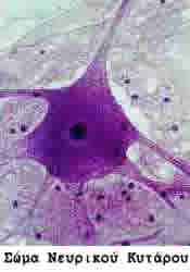 Σώμα νευρικού κυττάρου