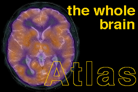 Τομογραφία εγκεφάλου